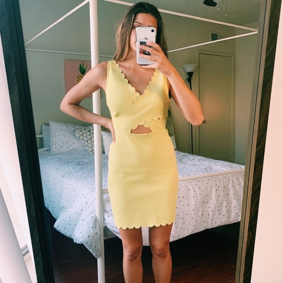 Topshop Dresses & Skirts - Topshop neon yellow scallop cut out mini dress